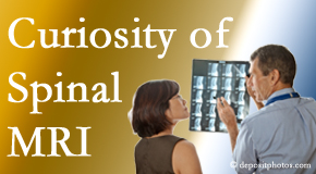Carrolltown MRIs for spinal stenosis may be revealing…or puzzling.