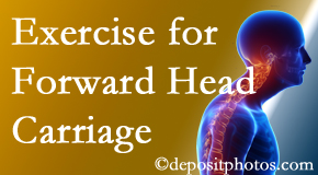 Carrolltown chiropractic treatment of forward head carriage is two-fold: manipulation and exercise.