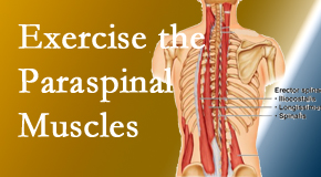 Gormish Chiropractic & Rehabilitation describes the importance of paraspinal muscles and their strength for Carrolltown back pain relief.