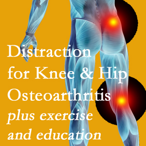 A chiropractic treatment plan for Carrolltown knee pain and hip pain caused by osteoarthritis: education, exercise, distraction.
