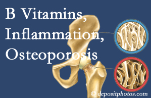 Carrolltown chiropractic care of osteoporosis often comes with nutritional tips like b vitamins for inflammation reduction and for prevention.