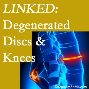 Degenerated discs and degenerated knees are not such strange bedfellows. They are seen to be related. Carrolltown patients with a loss of disc height due to disc degeneration often also have knee pain related to degeneration.  