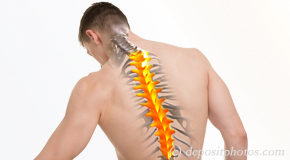 Carrolltown thoracic spine pain image 