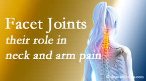 Gormish Chiropractic & Rehabilitation thoroughly examines, diagnoses, and treats cervical spine facet joints for neck pain relief when they are involved.