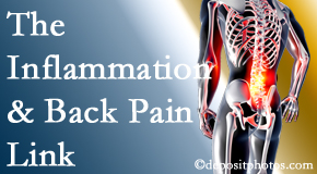 Gormish Chiropractic & Rehabilitation addresses the inflammatory process that accompanies back pain as well as the pain itself.