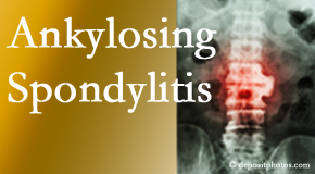 Ankylosing spondylitis is gently cared for by your Carrolltown chiropractor.