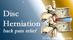 Gormish Chiropractic & Rehabilitation offers non-surgical treatment for relief of disc herniation related back pain. 