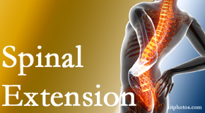 Gormish Chiropractic & Rehabilitation understands the role of extension in spinal motion, its necessity, its benefits and potential harmful effects. 