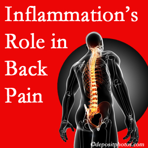The role of inflammation in Carrolltown back pain is real. Chiropractic care can manage it.