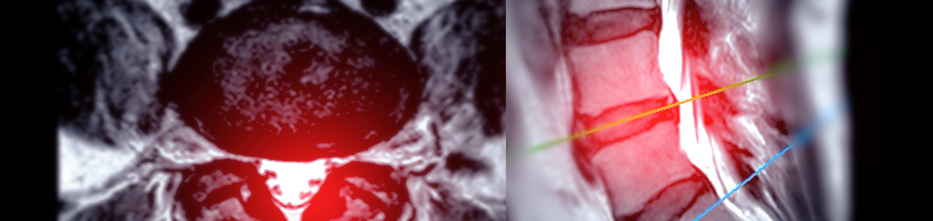Carrolltown back pain imaging and exercise