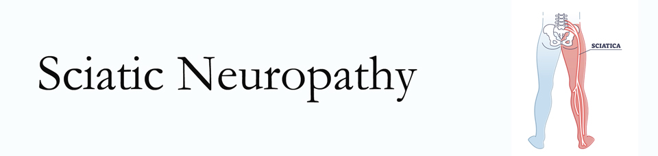 Carrolltown neuropathy pain (sciatica) 