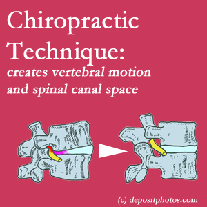 picture of a Carrolltown spinal stenotic canal