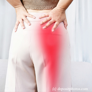 picture of Carrolltown leg pain, sciatica, lumbar radiculopathy