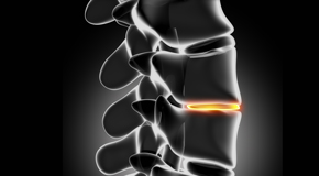 Carrolltown chiropractic nutrition with vitamin D and quercitrin