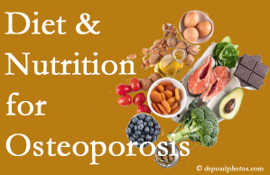 Carrolltown osteoporosis prevention tips from your chiropractor include improved diet and nutrition and reduced sodium, bad fats, and sugar intake. 