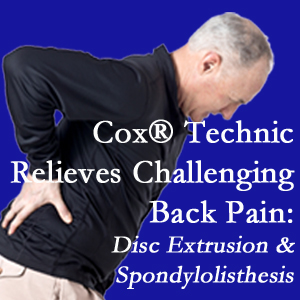 Carrolltown chiropractic care with Cox Technic relieves back pain due to a painful combination of a disc extrusion and a spondylolytic spondylolisthesis.